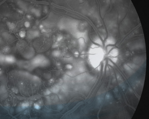 Retina scan visual